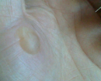 hand.jpg